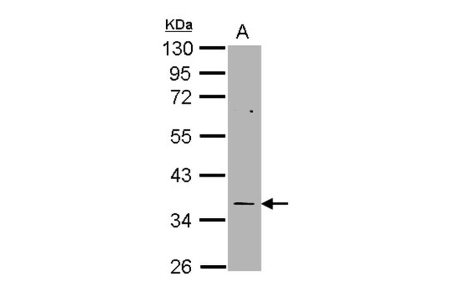 TS antibody from Signalway Antibody (22919) - Antibodies.com