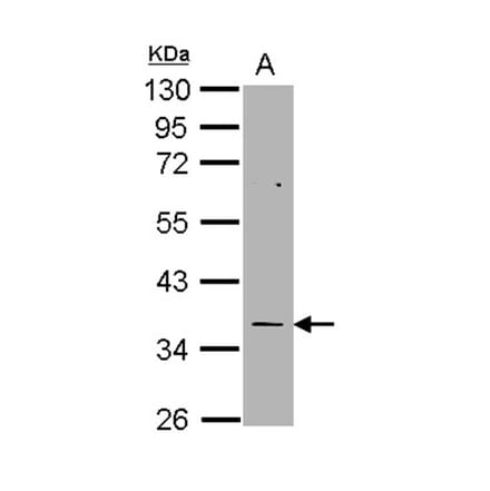 TS antibody from Signalway Antibody (22919) - Antibodies.com
