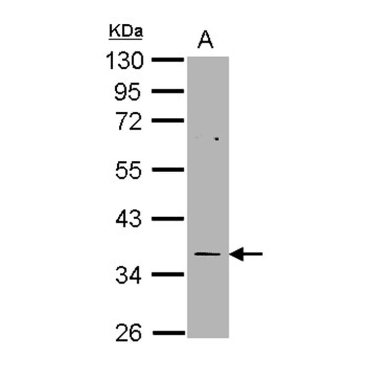 TS antibody from Signalway Antibody (22919) - Antibodies.com