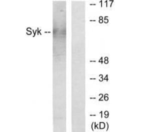 Western blot - Syk Antibody from Signalway Antibody (33491) - Antibodies.com