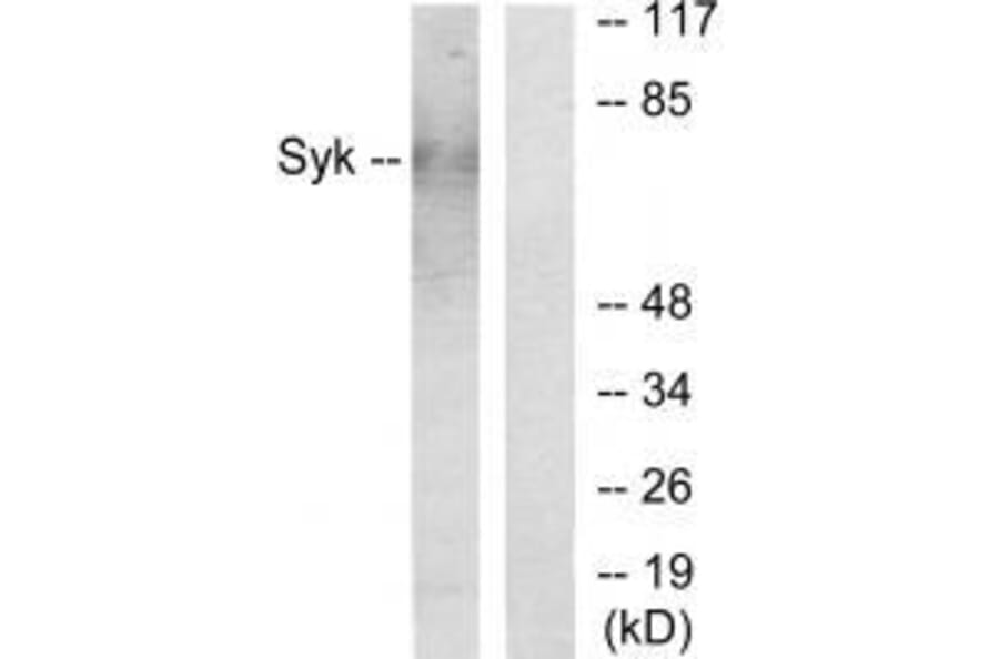 Western blot - Syk Antibody from Signalway Antibody (33491) - Antibodies.com
