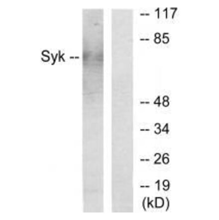 Western blot - Syk Antibody from Signalway Antibody (33491) - Antibodies.com