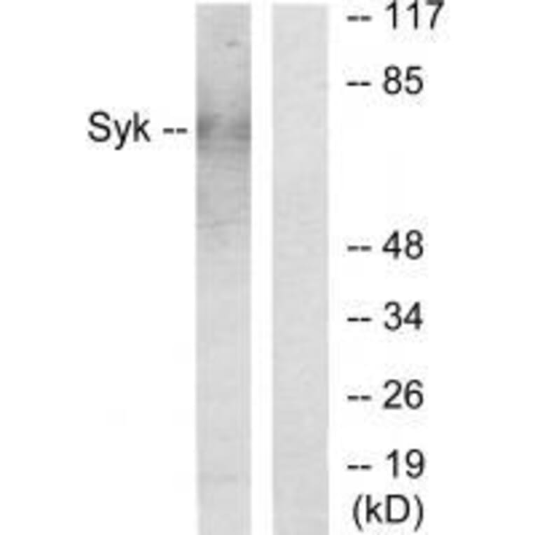 Western blot - Syk Antibody from Signalway Antibody (33491) - Antibodies.com