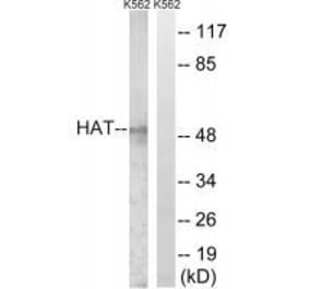 Western blot - HAT Antibody from Signalway Antibody (33511) - Antibodies.com