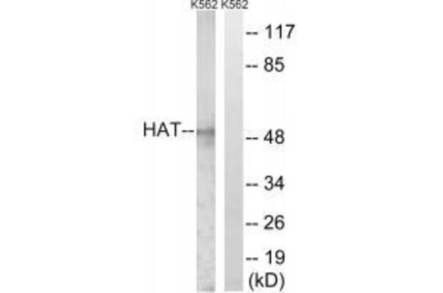 Western blot - HAT Antibody from Signalway Antibody (33511) - Antibodies.com