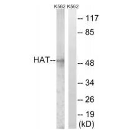 Western blot - HAT Antibody from Signalway Antibody (33511) - Antibodies.com