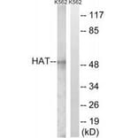 Western blot - HAT Antibody from Signalway Antibody (33511) - Antibodies.com