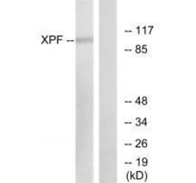 Western blot - XPF Antibody from Signalway Antibody (33545) - Antibodies.com