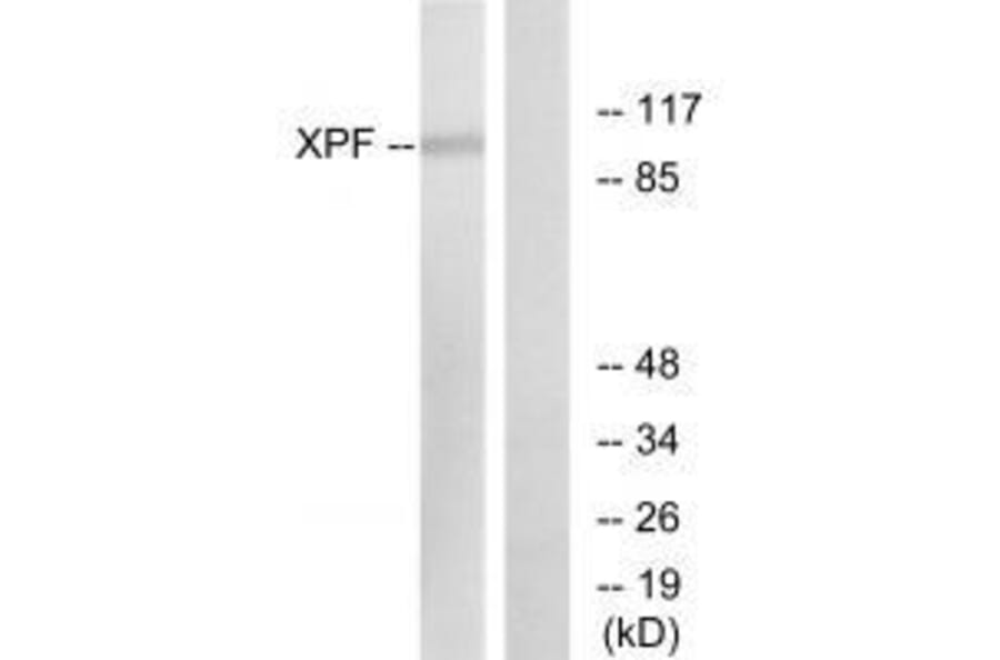Western blot - XPF Antibody from Signalway Antibody (33545) - Antibodies.com