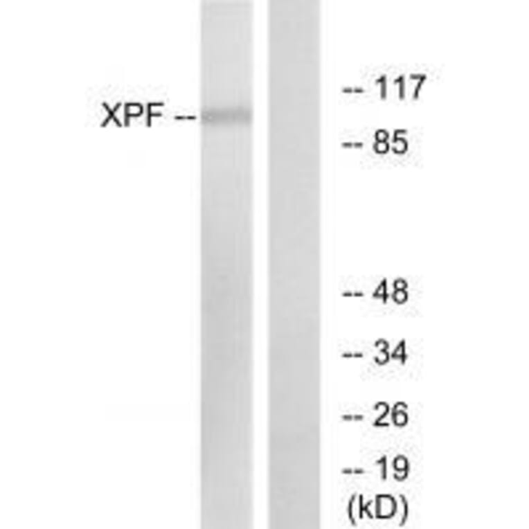 Western blot - XPF Antibody from Signalway Antibody (33545) - Antibodies.com