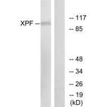 Western blot - XPF Antibody from Signalway Antibody (33545) - Antibodies.com