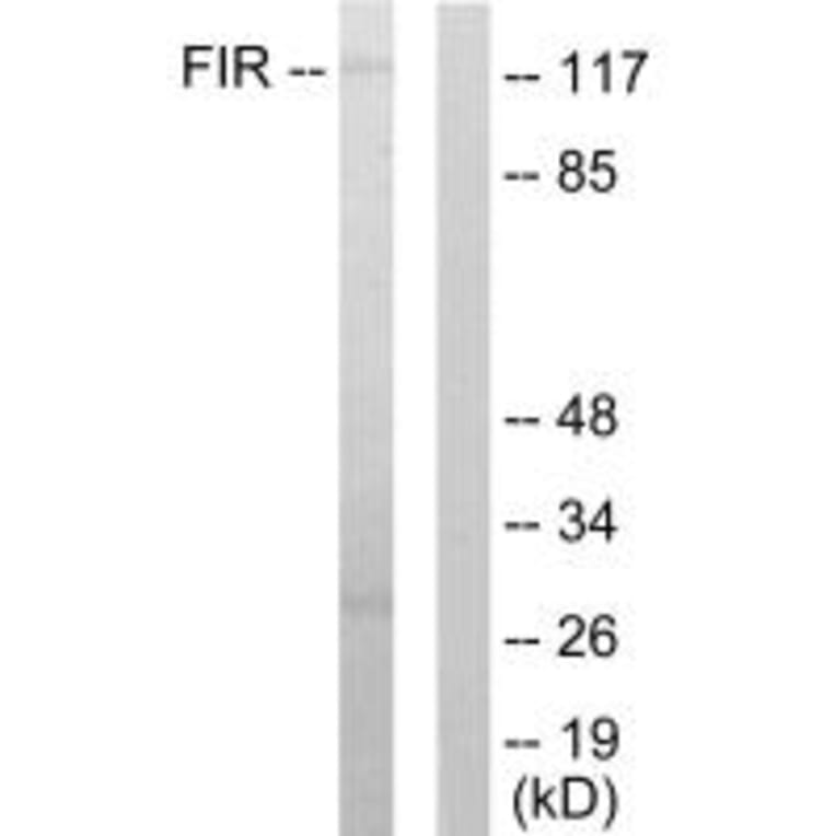 Western blot - FIR Antibody from Signalway Antibody (33622) - Antibodies.com