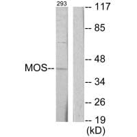 Western blot analysis of extracts from 293 cells, using MOS antibody #33645.