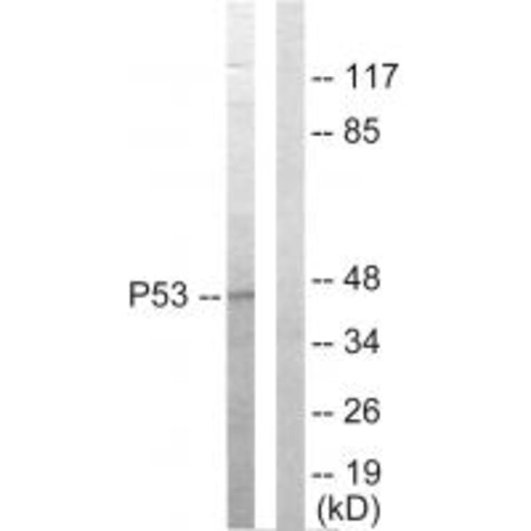 Western blot - p53 Antibody from Signalway Antibody (33650) - Antibodies.com
