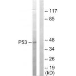 Western blot - p53 Antibody from Signalway Antibody (33650) - Antibodies.com