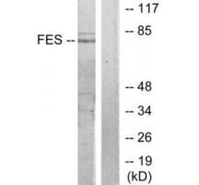 Western blot - FES Antibody from Signalway Antibody (33656) - Antibodies.com