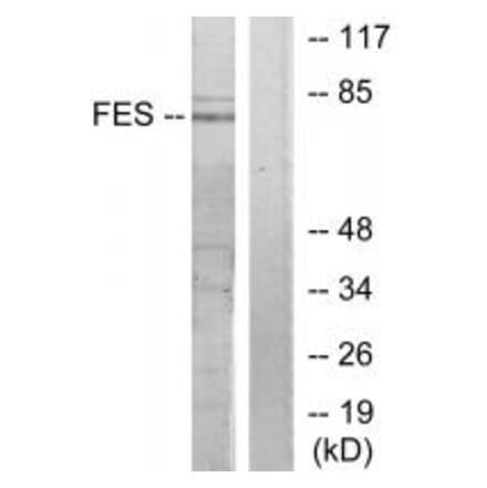 Western blot - FES Antibody from Signalway Antibody (33656) - Antibodies.com