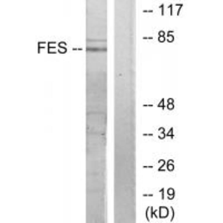 Western blot - FES Antibody from Signalway Antibody (33656) - Antibodies.com