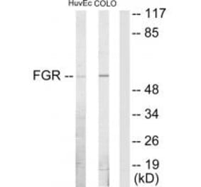 Western blot - FGR Antibody from Signalway Antibody (33664) - Antibodies.com