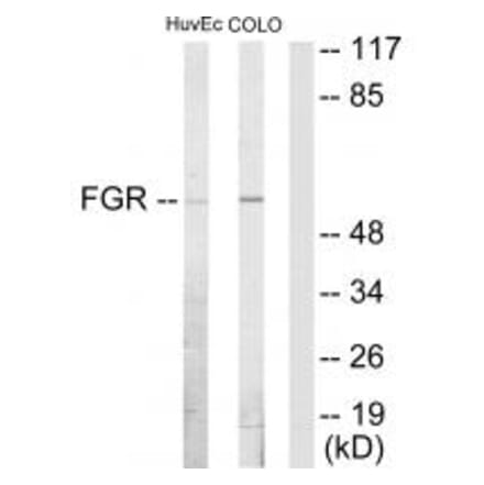 Western blot - FGR Antibody from Signalway Antibody (33664) - Antibodies.com