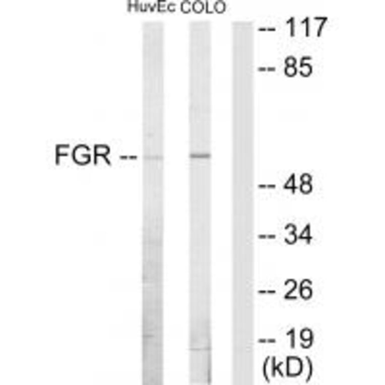 Western blot - FGR Antibody from Signalway Antibody (33664) - Antibodies.com