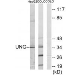 Western blot - UNG Antibody from Signalway Antibody (33676) - Antibodies.com