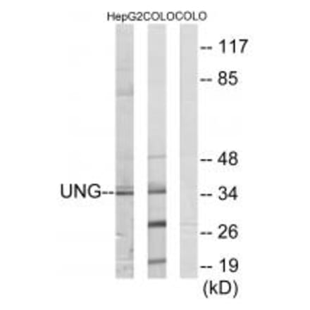 Western blot - UNG Antibody from Signalway Antibody (33676) - Antibodies.com