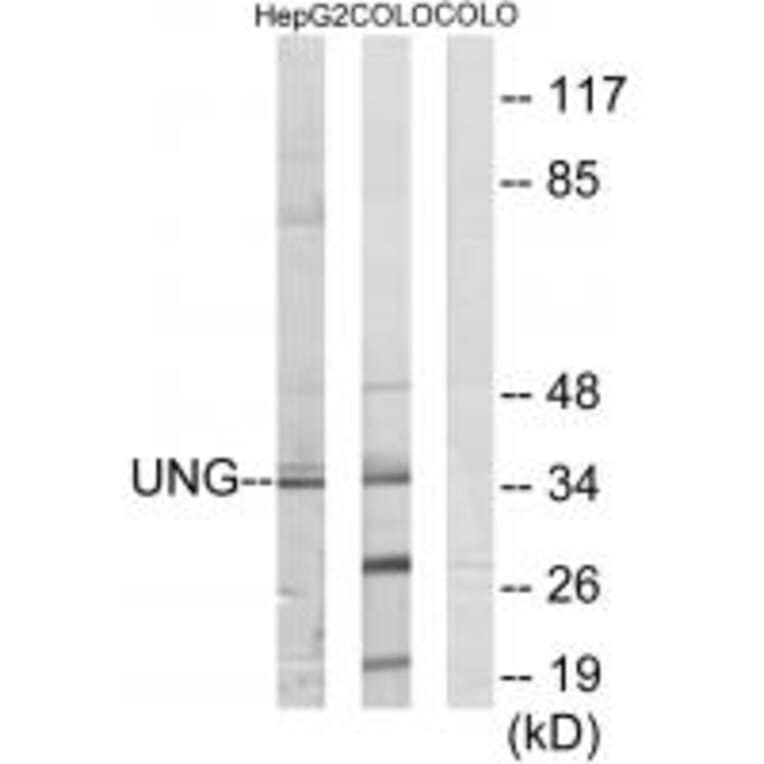 Western blot - UNG Antibody from Signalway Antibody (33676) - Antibodies.com