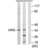 Western blot - UNG Antibody from Signalway Antibody (33676) - Antibodies.com