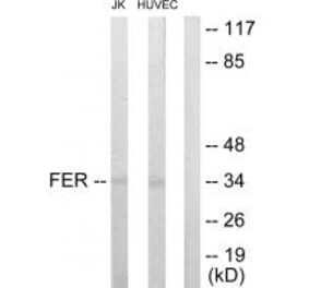 Western blot - FER Antibody from Signalway Antibody (33688) - Antibodies.com
