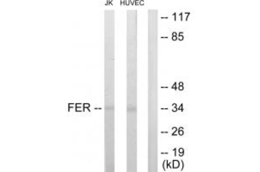 Western blot - FER Antibody from Signalway Antibody (33688) - Antibodies.com