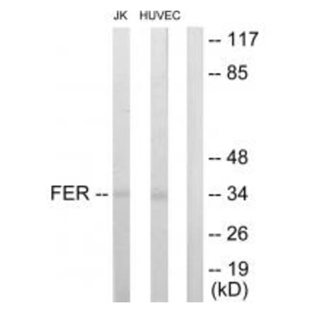 Western blot - FER Antibody from Signalway Antibody (33688) - Antibodies.com