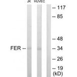 Western blot - FER Antibody from Signalway Antibody (33688) - Antibodies.com