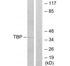 Western blot - TBP Antibody from Signalway Antibody (33709) - Antibodies.com