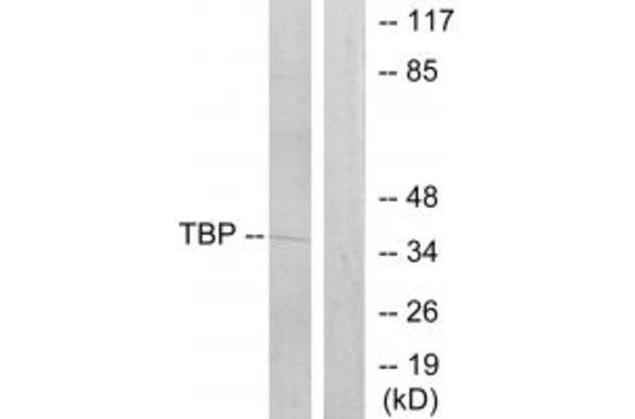 Western blot - TBP Antibody from Signalway Antibody (33709) - Antibodies.com