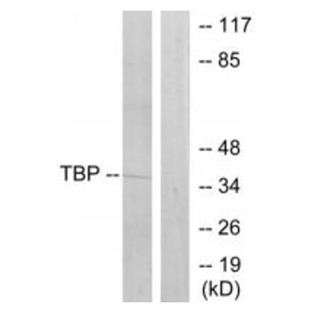 Western blot - TBP Antibody from Signalway Antibody (33709) - Antibodies.com