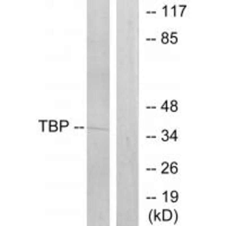 Western blot - TBP Antibody from Signalway Antibody (33709) - Antibodies.com