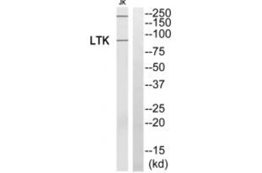 Western blot - LTK Antibody from Signalway Antibody (33742) - Antibodies.com