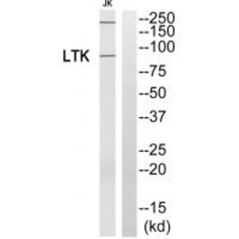 Western blot - LTK Antibody from Signalway Antibody (33742) - Antibodies.com