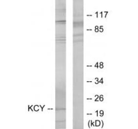 Western blot - KCY Antibody from Signalway Antibody (33743) - Antibodies.com