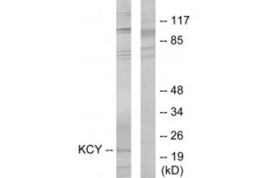 Western blot - KCY Antibody from Signalway Antibody (33743) - Antibodies.com