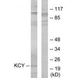 Western blot - KCY Antibody from Signalway Antibody (33743) - Antibodies.com