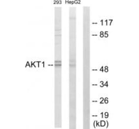 Western blot - Akt Antibody from Signalway Antibody (33748) - Antibodies.com