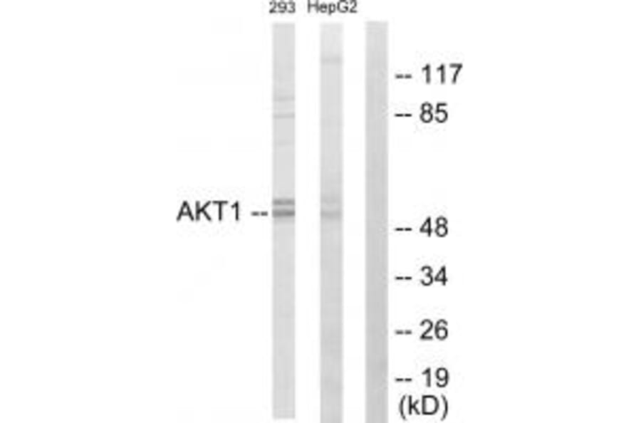 Western blot - Akt Antibody from Signalway Antibody (33748) - Antibodies.com