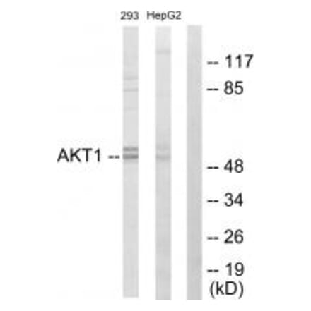 Western blot - Akt Antibody from Signalway Antibody (33748) - Antibodies.com