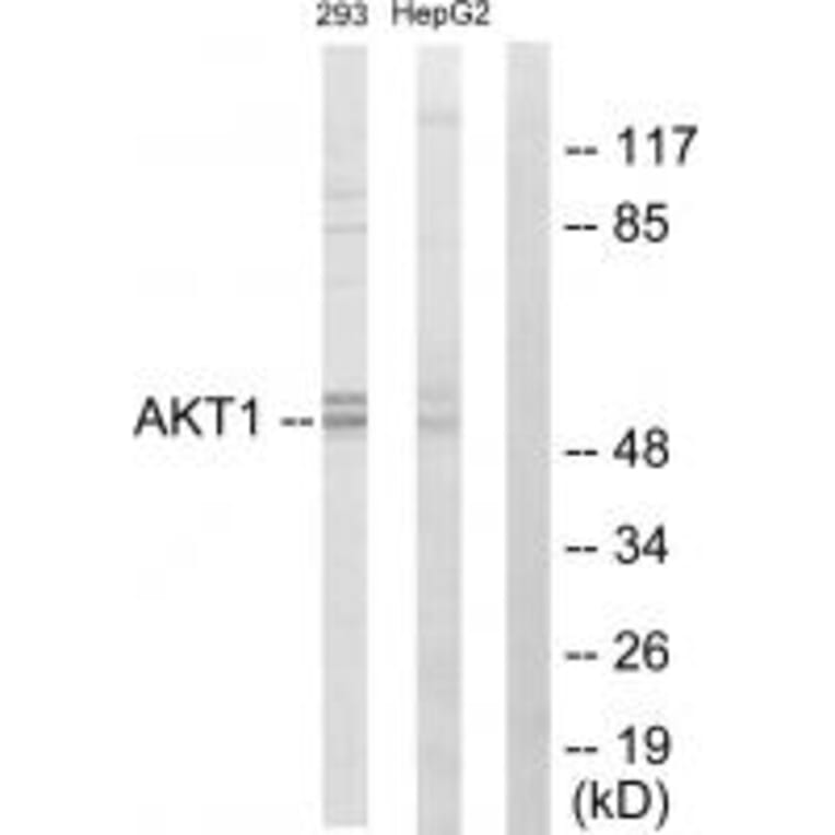 Western blot - Akt Antibody from Signalway Antibody (33748) - Antibodies.com