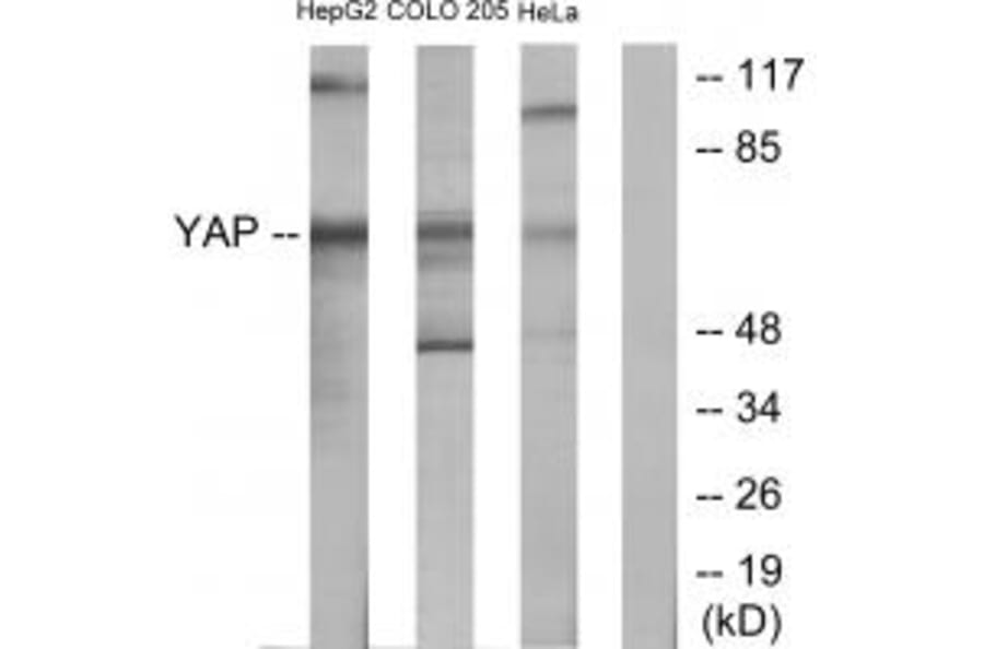 Western blot - YAP Antibody from Signalway Antibody (33778) - Antibodies.com