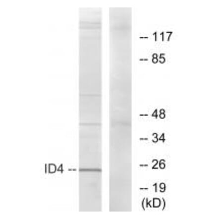 Western blot - ID4 Antibody from Signalway Antibody (33779) - Antibodies.com