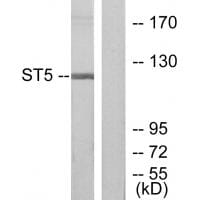 Western blot analysis of extracts from COLO205 cells, using ST5 antibody #33837.