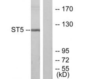 Western blot - ST5 Antibody from Signalway Antibody (33837) - Antibodies.com